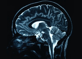 Brain and Head Injuries